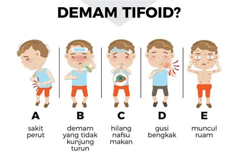 demam tifoid