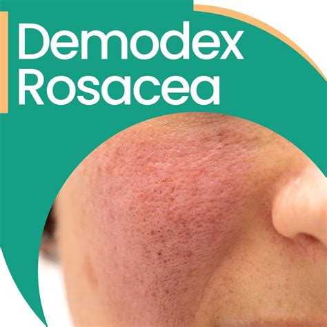 demodex behandling valp