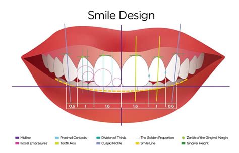 dental design smile #2