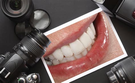 Read Online Dental Photography A New Perspective Ryoungdds 