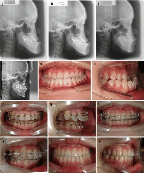 Dentofacial Deformities