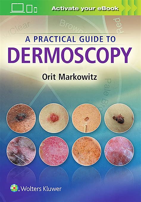 Dermoscopy Amazon