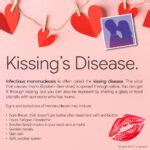 describe kissing disease symptoms