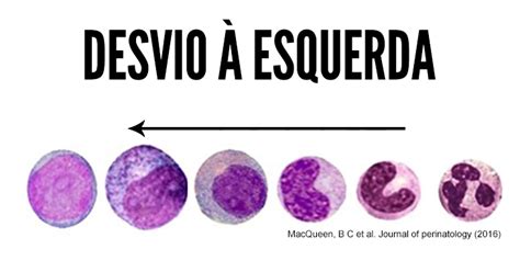 Desvio A Esquerda