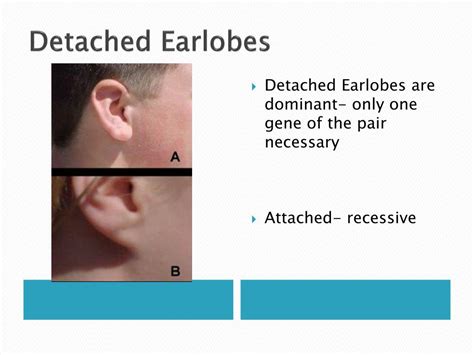 Detached Earlobes