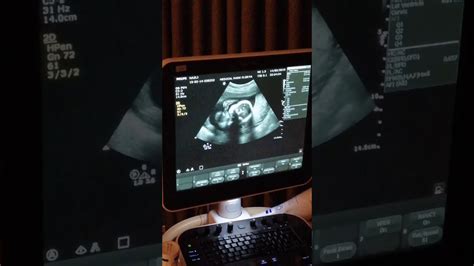 detaylı ultrason izmir