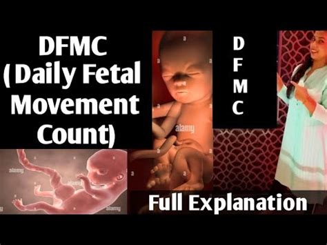 Dfmc In Pregnancy