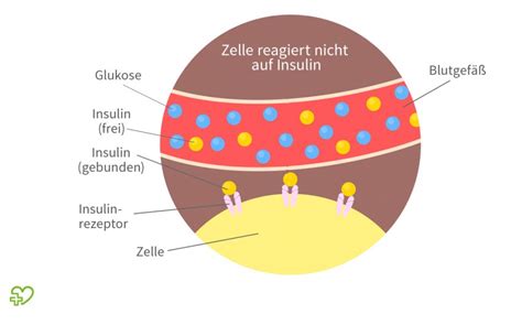 diabetes mellitus insulinmangel