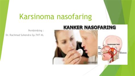 diagnosis banding karsinoma nasofaring pdf