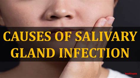 Full Download Diagnosis Of Salivary Gland Disorders 