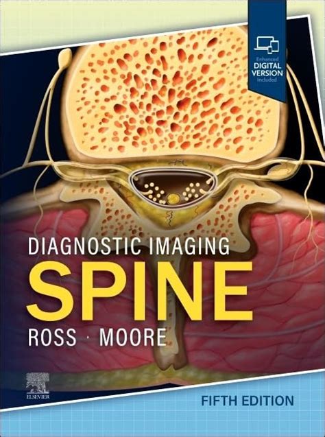 diagnostic imaging spine