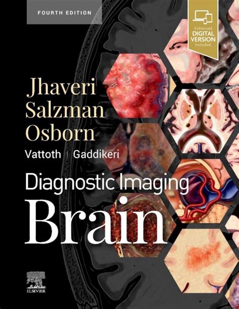 Read Diagnostic Imaging Brain 