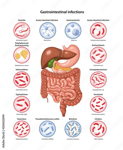 Digestive System Infections