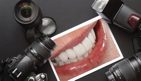 Read Online Digital Photography In Dentistry University Of Southern 