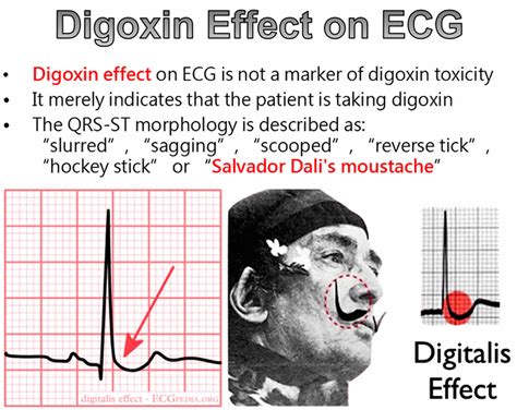 th?q=digoxin+op+recept