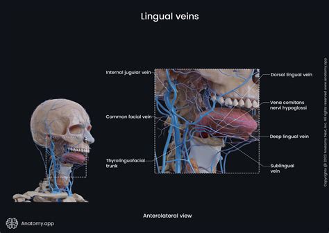 Dilated Lingual Veins