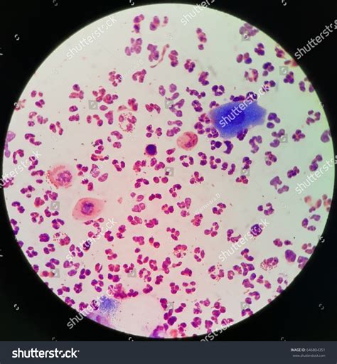 Diplococci Gram Negative Bacteria