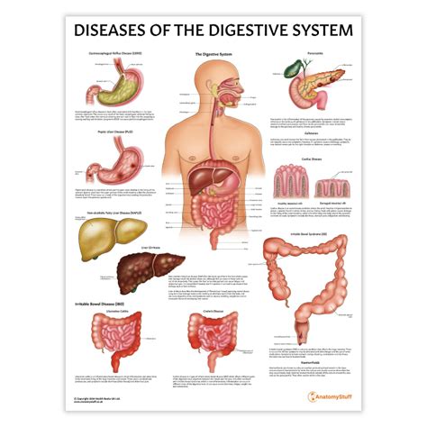 Diseases Of Digestive System Causes Cure And Prevention