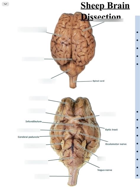 Dissection Of The Sheep Brain Lab 29 Answers
