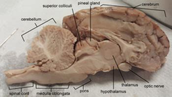 Read Online Dissection Of The Sheep Brain Lab 29 Answers 