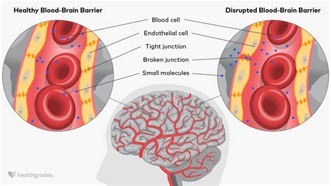 Distributed Barrier Does