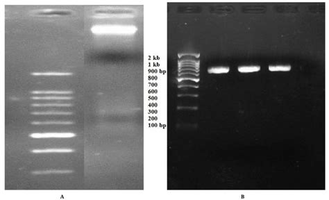Dna Band