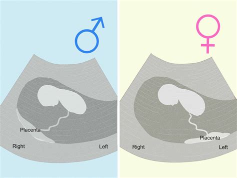 does a boy or girl move more in the womb