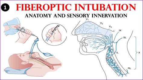 Does A Flexible Fiberoptic Intubation Need Power Source