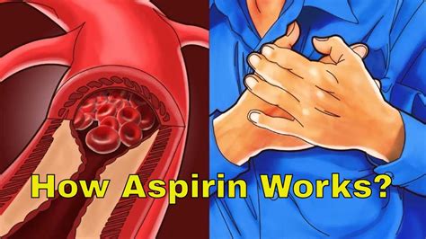 does aspirin help during a heart attack