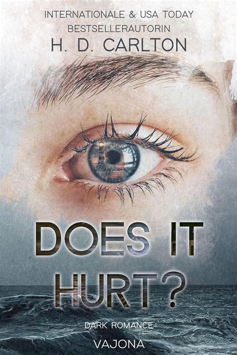 Does It Hurt Book