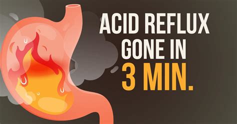 does kisses feel good for acid reflux