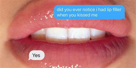does kissing affect lip fillers