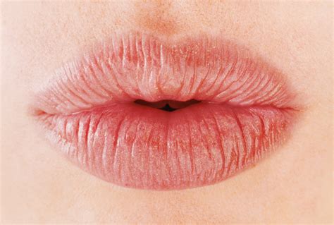 does kissing help chapped lips feel hard
