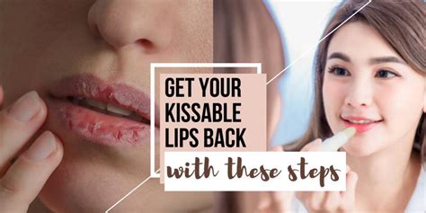 does kissing make your lips dry back