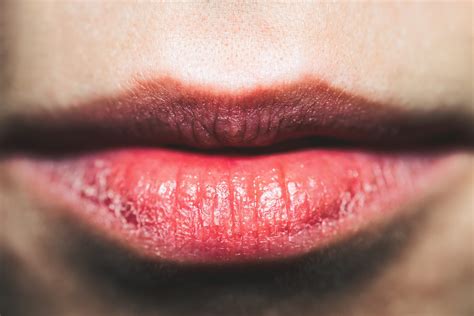 does kissing make your lips dry good