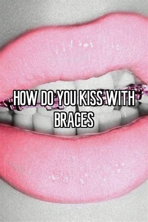 does kissing someone with braces cause pain treatment