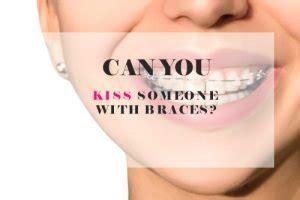 does kissing someone with braces cause