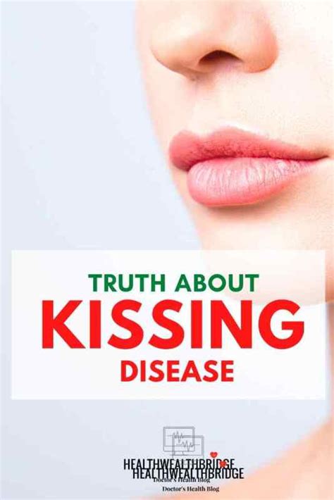 does lip size affect kissing disease symptoms