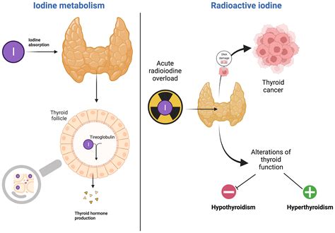 Does Thymus Uptake Iodine