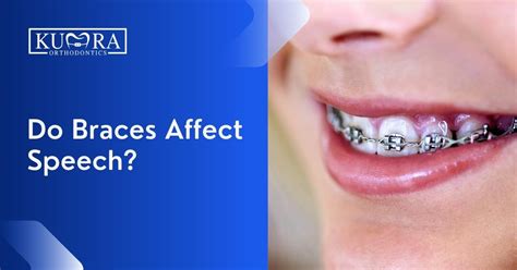 does wearing braces affect your speech activity