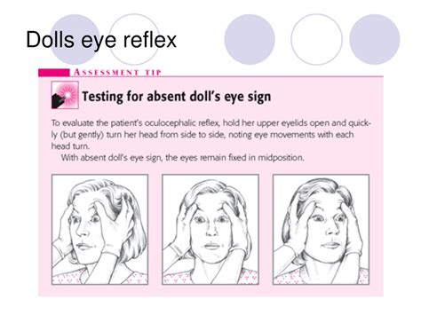 Dolls Eye Reflex
