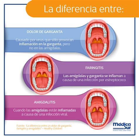 Dolor De Garganta Termino Medico