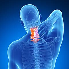 dolore al collo persistente