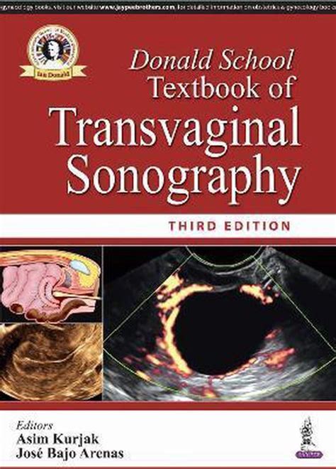 Read Donald School Textbook Of Transvaginal Sonography Full 