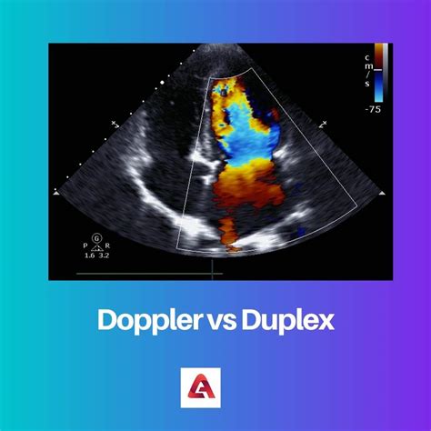 doppler - doppler fetal