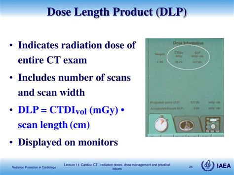Dose Length Product