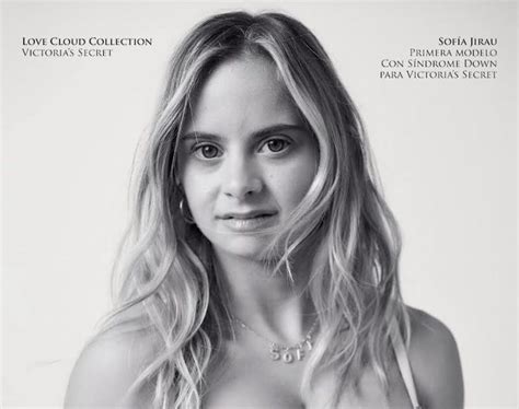 downs syndrome nude
