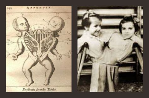 dr. mengele experiments list