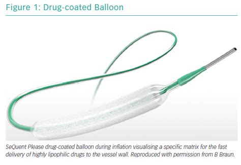 Drug Coated Balloon Remains Superior To Uncoated Balloon Science Balloon - Science Balloon