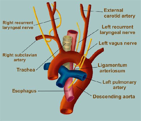 Ductus Arteriosus Ligamentum Arteriosum